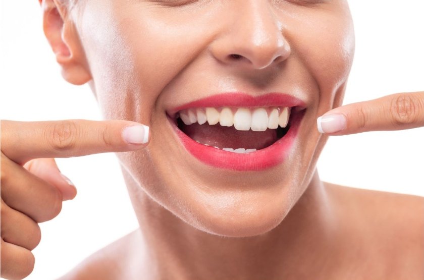 over-the-counter teeth whitening UK